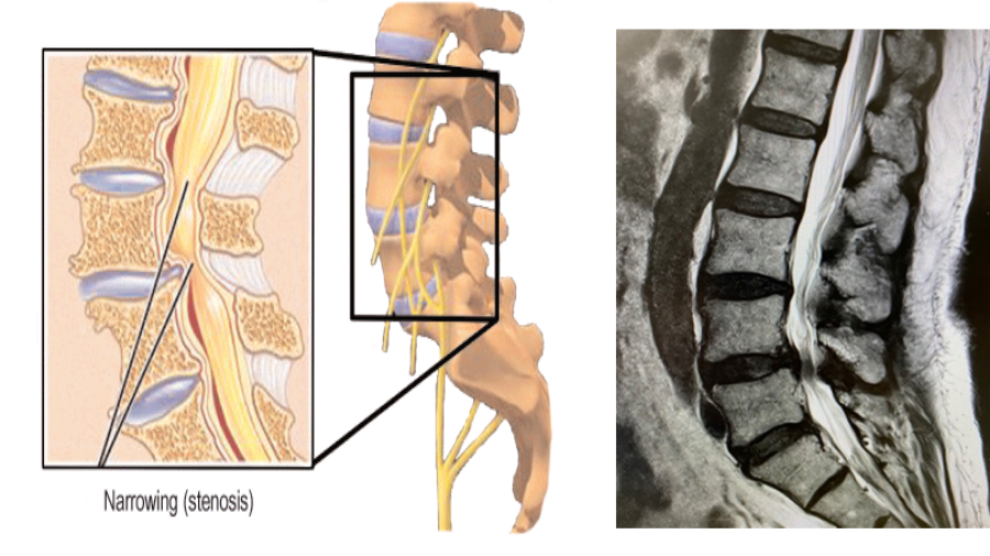 Small Incisions, Big Results Tan Tock Seng Hospital